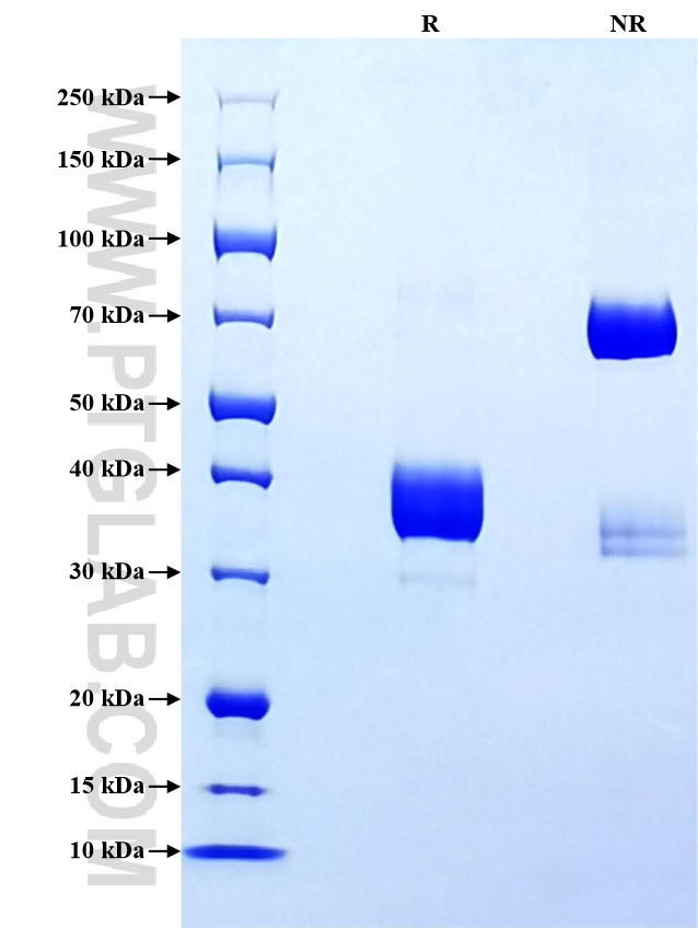 Purity of Recombinant Human CXCL2 was determined by SDS-PAGE. The protein was resolved in an SDS-PAGE in reducing (R) and non-reducing (NR) conditions and stained using Coomassie blue. Purity of Recombinant Human CXCL2 was determined by SDS-PAGE. The protein was resolved in an SDS-PAGE in reducing (R) and non-reducing (NR) conditions and stained using Coomassie blue.