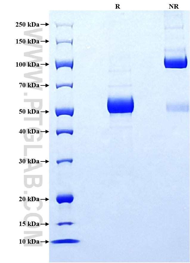 Purity of Recombinant Human Angiopoietin-1 was determined by SDS-PAGE. The protein was resolved in an SDS-PAGE in reducing (R) and non-reducing (NR) conditions and stained using Coomassie blue. Purity of Recombinant Human Angiopoietin-1 was determined by SDS-PAGE. The protein was resolved in an SDS-PAGE in reducing (R) and non-reducing (NR) conditions and stained using Coomassie blue.