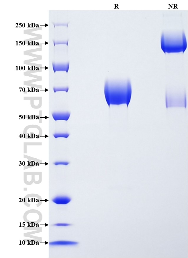 Purity of Recombinant Human IL-10RB was determined by SDS-PAGE. The protein was resolved in an SDS-PAGE in reducing (R) and non-reducing (NR) conditions and stained using Coomassie blue.