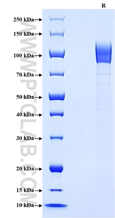 Purity of Recombinant Mouse CD36 was determined by SDS-PAGE. The protein was resolved in an SDS-PAGE in reducing (R) conditions and stained using Coomassie blue.