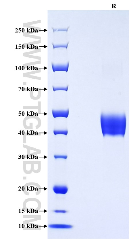 Purity of Recombinant Human CD151 was determined by SDS-PAGE. The protein was resolved in an SDS-PAGE in reducing (R) conditions and stained using Coomassie blue.