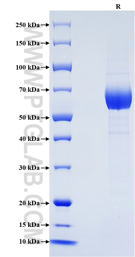 Purity of Recombinant Human KIR2DL5 was determined by SDS-PAGE. The protein was resolved in an SDS-PAGE in reducing (R) conditions and stained using Coomassie blue. Purity of Recombinant Human KIR2DL5 was determined by SDS-PAGE. The protein was resolved in an SDS-PAGE in reducing (R) conditions and stained using Coomassie blue.