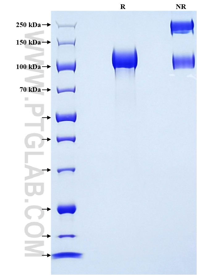 Purity of Recombinant Mouse EGFR was determined by SDS-PAGE. The protein was resolved in an SDS-PAGE in reducing (R) and non-reducing (NR) conditions and stained using Coomassie blue.