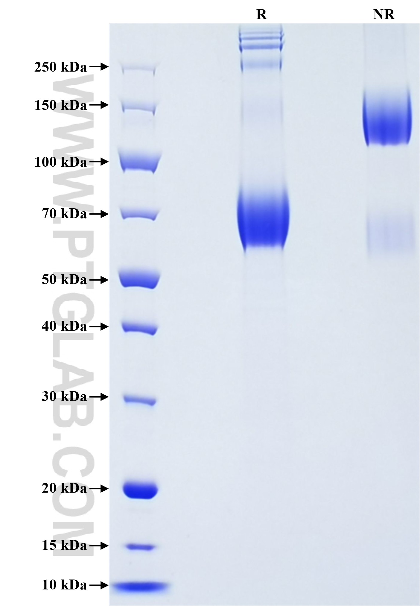 Purity of Recombinant Human CD80 was determined by SDS-PAGE. The protein was resolved in an SDS-PAGE in reducing (R) and non-reducing (NR) conditions and stained using Coomassie blue. Purity of Recombinant Human CD80 was determined by SDS-PAGE. The protein was resolved in an SDS-PAGE in reducing (R) and non-reducing (NR) conditions and stained using Coomassie blue.