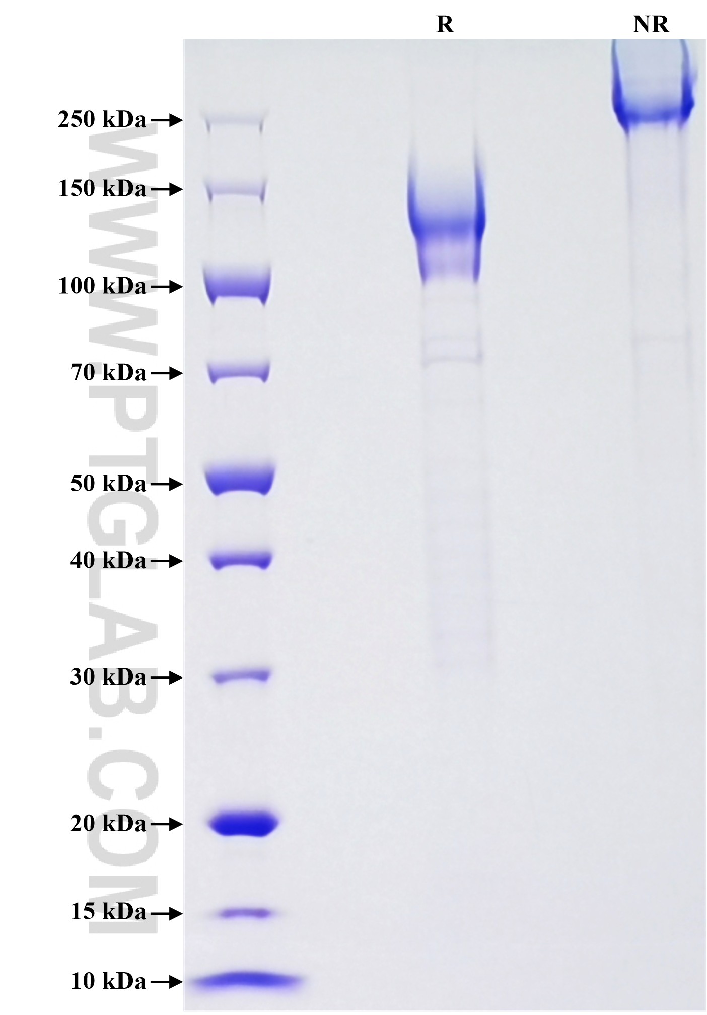 Purity of Recombinant Human CD96 was determined by SDS-PAGE. The protein was resolved in an SDS-PAGE in reducing (R) and non-reducing (NR) conditions and stained using Coomassie blue. Purity of Recombinant Human CD96 was determined by SDS-PAGE. The protein was resolved in an SDS-PAGE in reducing (R) and non-reducing (NR) conditions and stained using Coomassie blue.