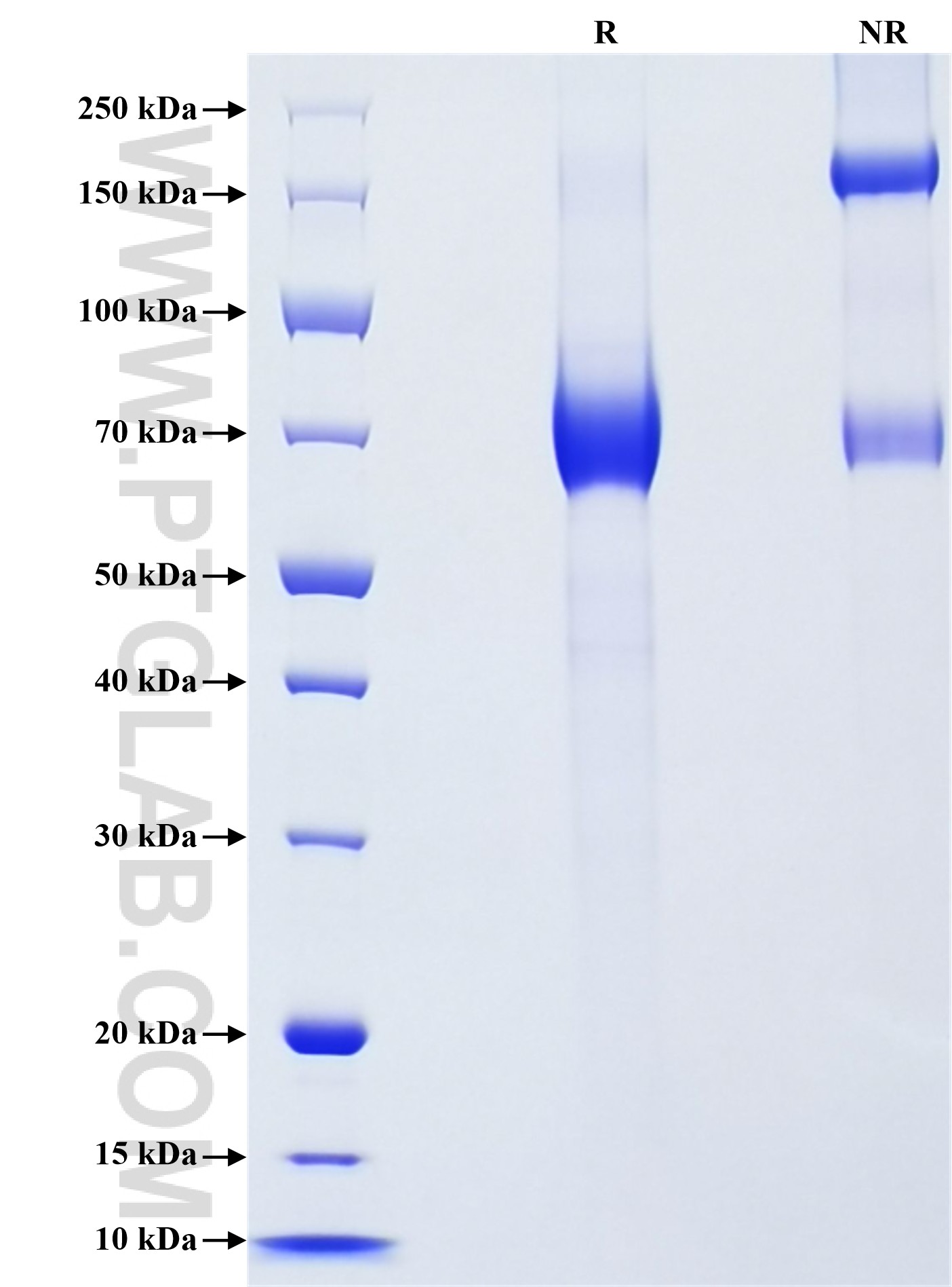 Purity of Recombinant Human KIR3DL1 was determined by SDS-PAGE. The protein was resolved in an SDS-PAGE in reducing (R) and non-reducing (NR) conditions and stained using Coomassie blue.