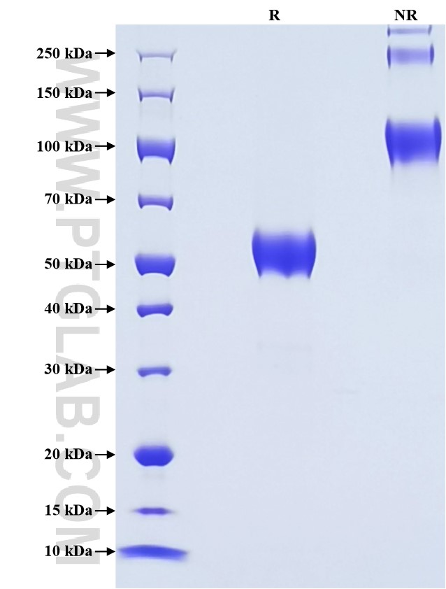 Purity of Recombinant Mouse HE4 was determined by SDS-PAGE. The protein was resolved in an SDS-PAGE in reducing (R) and non-reducing (NR) conditions and stained using Coomassie blue. Purity of Recombinant Mouse HE4 was determined by SDS-PAGE. The protein was resolved in an SDS-PAGE in reducing (R) and non-reducing (NR) conditions and stained using Coomassie blue.