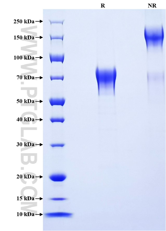 Purity of Recombinant Human IL15RA was determined by SDS-PAGE. The protein was resolved in an SDS-PAGE in reducing (R) and non-reducing (NR) conditions and stained using Coomassie blue. Purity of Recombinant Human IL15RA was determined by SDS-PAGE. The protein was resolved in an SDS-PAGE in reducing (R) and non-reducing (NR) conditions and stained using Coomassie blue.
