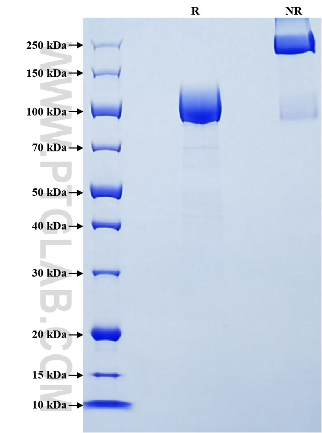 Purity of Recombinant Human CSF1R was determined by SDS-PAGE. The protein was resolved in an SDS-PAGE in reducing (R) and non-reducing (NR) conditions and stained using Coomassie blue. Purity of Recombinant Human CSF1R was determined by SDS-PAGE. The protein was resolved in an SDS-PAGE in reducing (R) and non-reducing (NR) conditions and stained using Coomassie blue.
