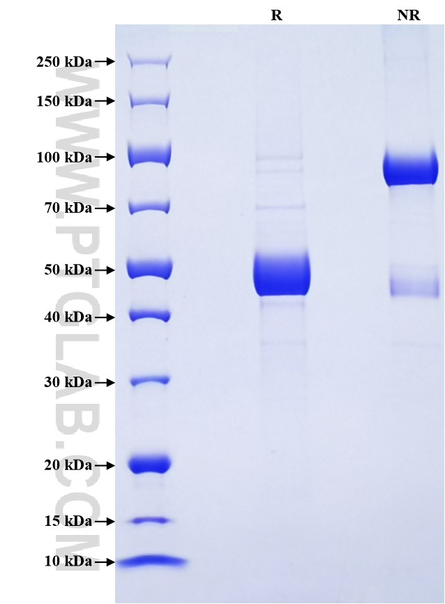 Purity of Recombinant Human TNFSF13 was determined by SDS-PAGE. The protein was resolved in an SDS-PAGE in reducing (R) and non-reducing (NR) conditions and stained using Coomassie blue. Purity of Recombinant Human TNFSF13 was determined by SDS-PAGE. The protein was resolved in an SDS-PAGE in reducing (R) and non-reducing (NR) conditions and stained using Coomassie blue.