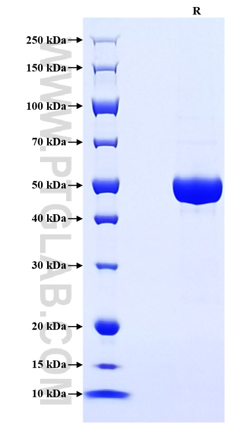 Purity of Recombinant Human PGLYRP1 was determined by SDS-PAGE. The protein was resolved in an SDS-PAGE in reducing (R) conditions and stained using Coomassie blue. Purity of Recombinant Human PGLYRP1 was determined by SDS-PAGE. The protein was resolved in an SDS-PAGE in reducing (R) conditions and stained using Coomassie blue.