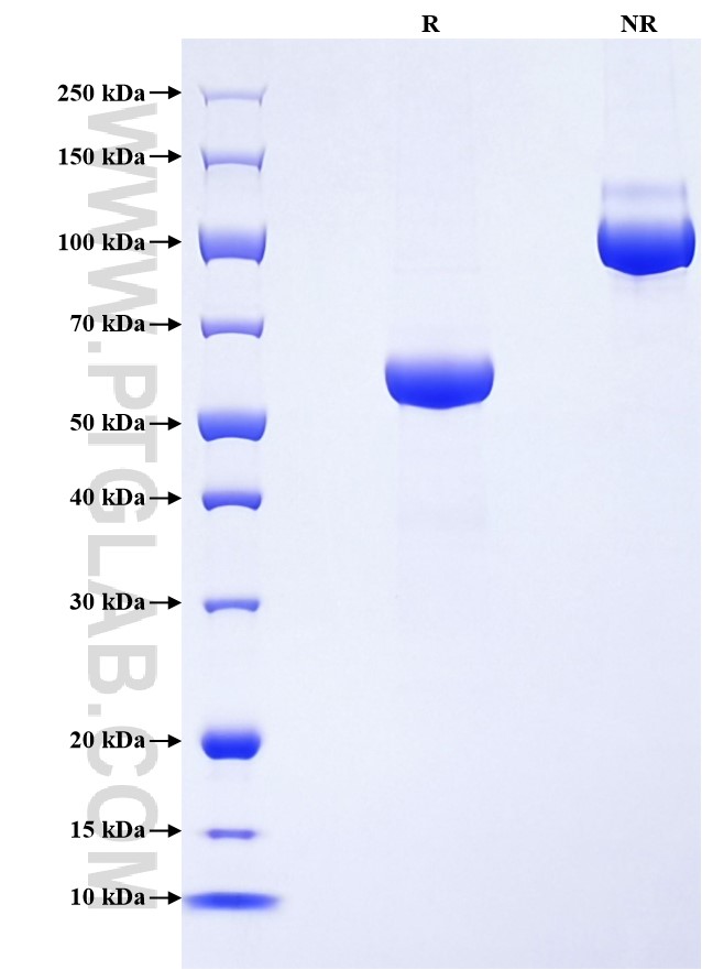 Purity of Recombinant Human Kallikrein 10 was determined by SDS-PAGE. The protein was resolved in an SDS-PAGE in reducing (R) and non-reducing (NR) conditions and stained using Coomassie blue. Purity of Recombinant Human Kallikrein 10 was determined by SDS-PAGE. The protein was resolved in an SDS-PAGE in reducing (R) and non-reducing (NR) conditions and stained using Coomassie blue.