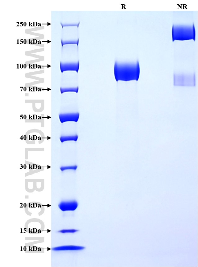 Purity of Recombinant Human LILRB1 was determined by SDS-PAGE. The protein was resolved in an SDS-PAGE in reducing (R) and non-reducing (NR) conditions and stained using Coomassie blue.