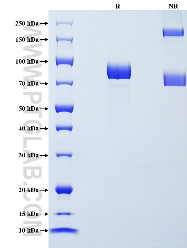 Purity of Recombinant Human PSG1 was determined by SDS-PAGE. The protein was resolved in an SDS-PAGE in reducing (R) and non-reducing (NR) conditions and stained using Coomassie blue.