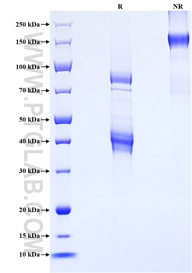 Purity of Recombinant Mouse TGF beta 1 was determined by SDS-PAGE. The protein was resolved in an SDS-PAGE in reducing (R) and non-reducing (NR) conditions and stained using Coomassie blue. Purity of Recombinant Mouse TGF beta 1 was determined by SDS-PAGE. The protein was resolved in an SDS-PAGE in reducing (R) and non-reducing (NR) conditions and stained using Coomassie blue.