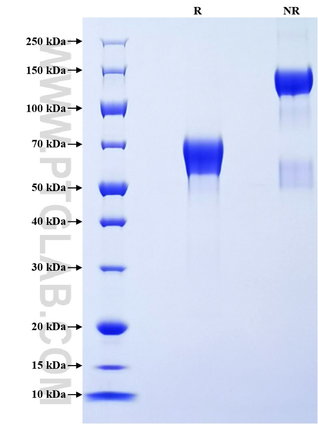Purity of Recombinant Human KIR2DS2 was determined by SDS-PAGE. The protein was resolved in an SDS-PAGE in reducing (R) and non-reducing (NR) conditions and stained using Coomassie blue. Purity of Recombinant Human KIR2DS2 was determined by SDS-PAGE. The protein was resolved in an SDS-PAGE in reducing (R) and non-reducing (NR) conditions and stained using Coomassie blue.