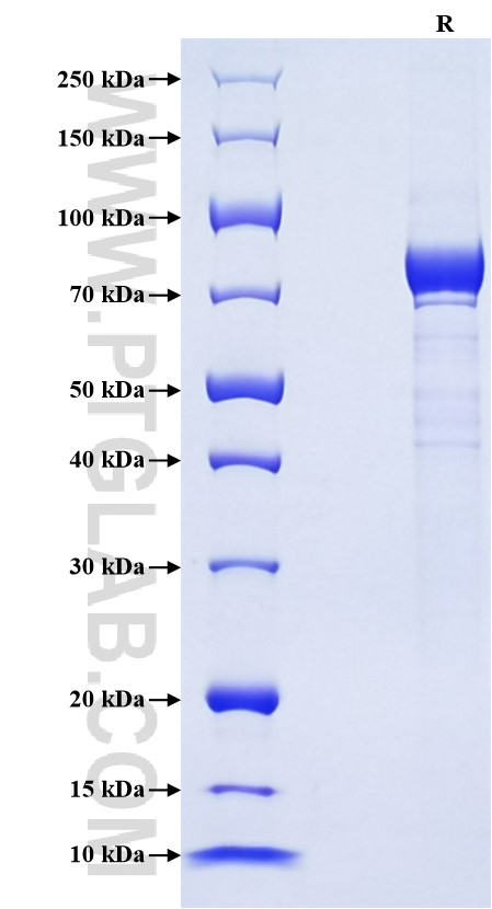 Purity of Recombinant Human PAFAH was determined by SDS-PAGE. The protein was resolved in an SDS-PAGE in reducing (R) conditions and stained using Coomassie blue.