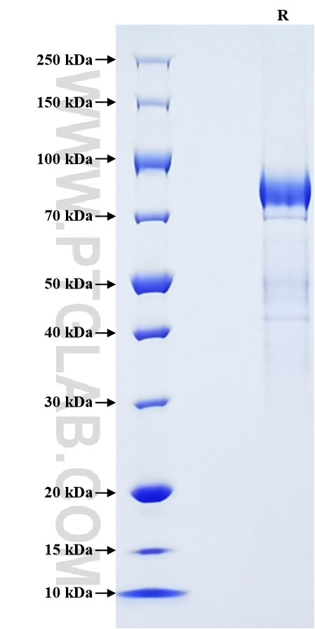 Purity of Recombinant Human KIR3DL2 was determined by SDS-PAGE. The protein was resolved in an SDS-PAGE in reducing (R) conditions and stained using Coomassie blue.