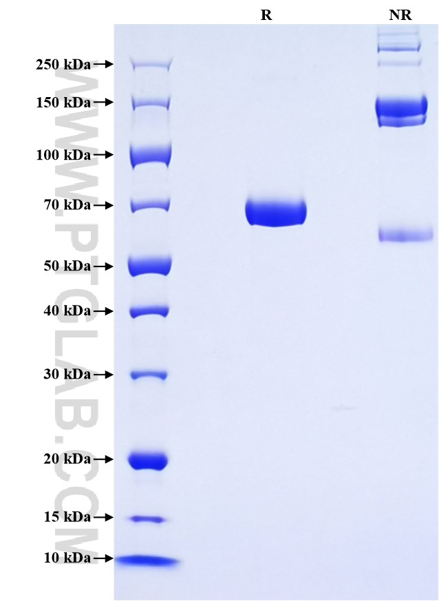 Purity of Recombinant Rat IL-12B was determined by SDS-PAGE. The protein was resolved in an SDS-PAGE in reducing (R) and non-reducing (NR) conditions and stained using Coomassie blue.