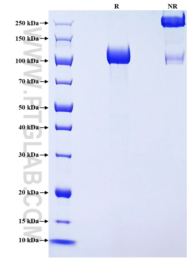 Purity of Recombinant Rat Vcam1 was determined by SDS-PAGE. The protein was resolved in an SDS-PAGE in reducing (R) and non-reducing (NR) conditions and stained using Coomassie blue. Purity of Recombinant Rat Vcam1 was determined by SDS-PAGE. The protein was resolved in an SDS-PAGE in reducing (R) and non-reducing (NR) conditions and stained using Coomassie blue.