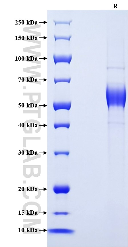 Purity of Recombinant Rat IL-12A was determined by SDS-PAGE. The protein was resolved in an SDS-PAGE in reducing (R) conditions and stained using Coomassie blue. Purity of Recombinant Rat IL-12A was determined by SDS-PAGE. The protein was resolved in an SDS-PAGE in reducing (R) conditions and stained using Coomassie blue.