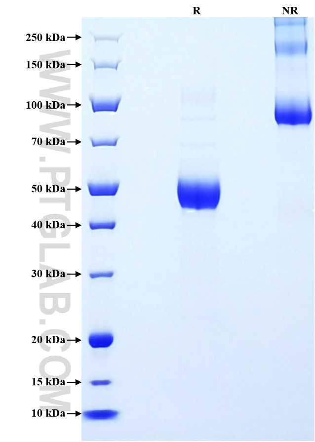 Purity of Recombinant Mouse Il-7 was determined by SDS-PAGE. The protein was resolved in an SDS-PAGE in reducing (R) and non-reducing (NR) conditions and stained using Coomassie blue. Purity of Recombinant Mouse Il-7 was determined by SDS-PAGE. The protein was resolved in an SDS-PAGE in reducing (R) and non-reducing (NR) conditions and stained using Coomassie blue.
