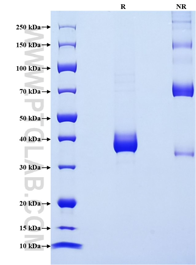 Purity of Recombinant Mouse CD81 was determined by SDS-PAGE. The protein was resolved in an SDS-PAGE in reducing (R) and non-reducing (NR) conditions and stained using Coomassie blue. Purity of Recombinant Mouse CD81 was determined by SDS-PAGE. The protein was resolved in an SDS-PAGE in reducing (R) and non-reducing (NR) conditions and stained using Coomassie blue.