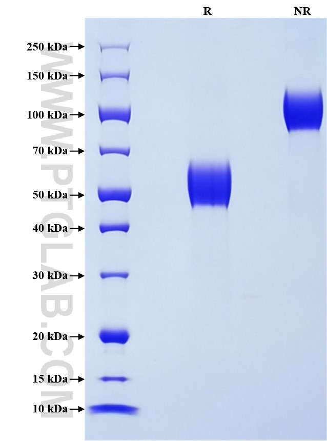Purity of Recombinant Mouse CD69 was determined by SDS-PAGE. The protein was resolved in an SDS-PAGE in reducing (R) and non-reducing (NR) conditions and stained using Coomassie blue. Purity of Recombinant Mouse CD69 was determined by SDS-PAGE. The protein was resolved in an SDS-PAGE in reducing (R) and non-reducing (NR) conditions and stained using Coomassie blue.