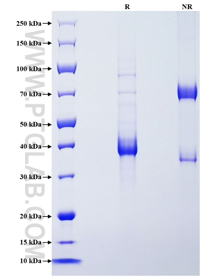 Purity of Recombinant Human SAA2 was determined by SDS-PAGE. The protein was resolved in an SDS-PAGE in reducing (R) and non-reducing (NR) conditions and stained using Coomassie blue. Purity of Recombinant Human SAA2 was determined by SDS-PAGE. The protein was resolved in an SDS-PAGE in reducing (R) and non-reducing (NR) conditions and stained using Coomassie blue.
