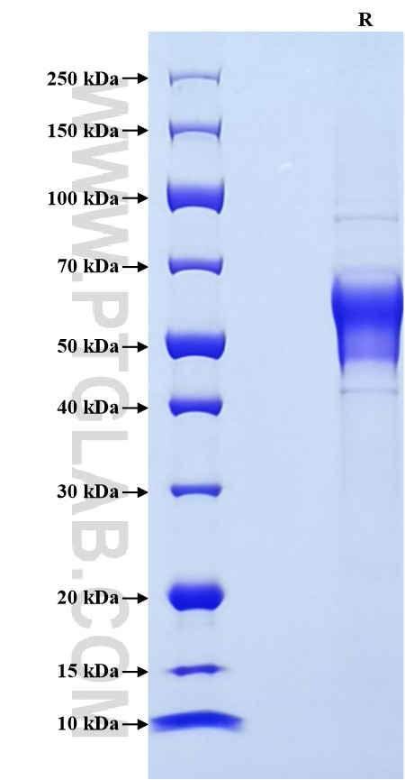 Purity of Recombinant Mouse CD94 was determined by SDS-PAGE. The protein was resolved in an SDS-PAGE in reducing (R) conditions and stained using Coomassie blue. Purity of Recombinant Mouse CD94 was determined by SDS-PAGE. The protein was resolved in an SDS-PAGE in reducing (R) conditions and stained using Coomassie blue.