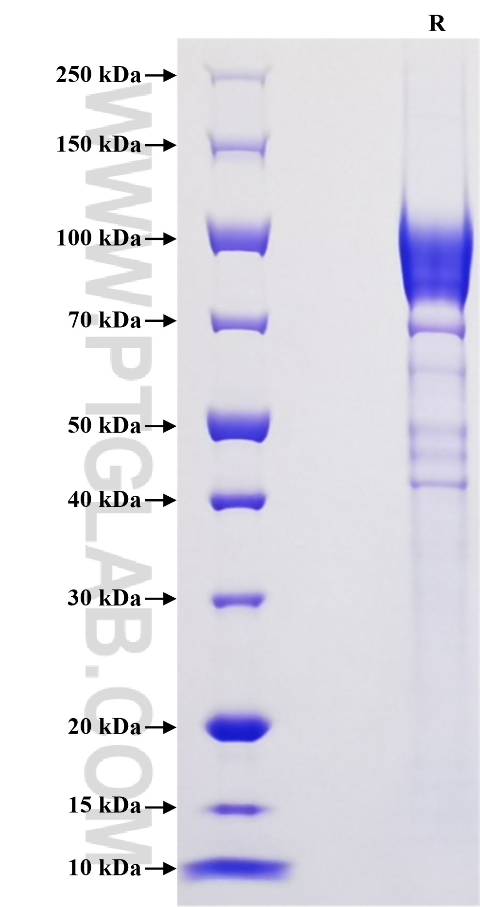 Purity of Recombinant Mouse CD62L was determined by SDS-PAGE. The protein was resolved in an SDS-PAGE in reducing (R) conditions and stained using Coomassie blue.