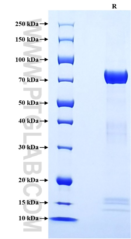 Purity of Recombinant Human AGER was determined by SDS-PAGE. The protein was resolved in an SDS-PAGE in reducing (R) conditions and stained using Coomassie blue.