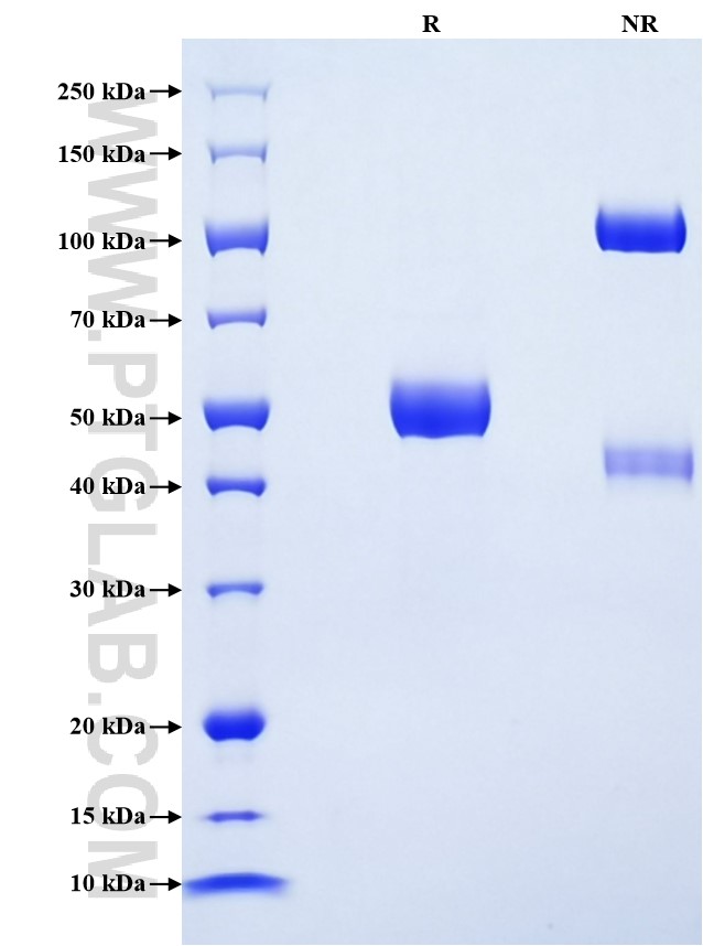 Purity of Recombinant Mouse FAM3D was determined by SDS-PAGE. The protein was resolved in an SDS-PAGE in reducing (R) and non-reducing (NR) conditions and stained using Coomassie blue. Purity of Recombinant Mouse FAM3D was determined by SDS-PAGE. The protein was resolved in an SDS-PAGE in reducing (R) and non-reducing (NR) conditions and stained using Coomassie blue.