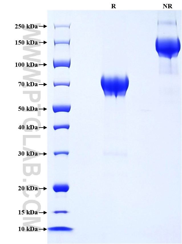 Purity of Recombinant Mouse p75NTR was determined by SDS-PAGE. The protein was resolved in an SDS-PAGE in reducing (R) and non-reducing (NR) conditions and stained using Coomassie blue. Purity of Recombinant Mouse p75NTR was determined by SDS-PAGE. The protein was resolved in an SDS-PAGE in reducing (R) and non-reducing (NR) conditions and stained using Coomassie blue.
