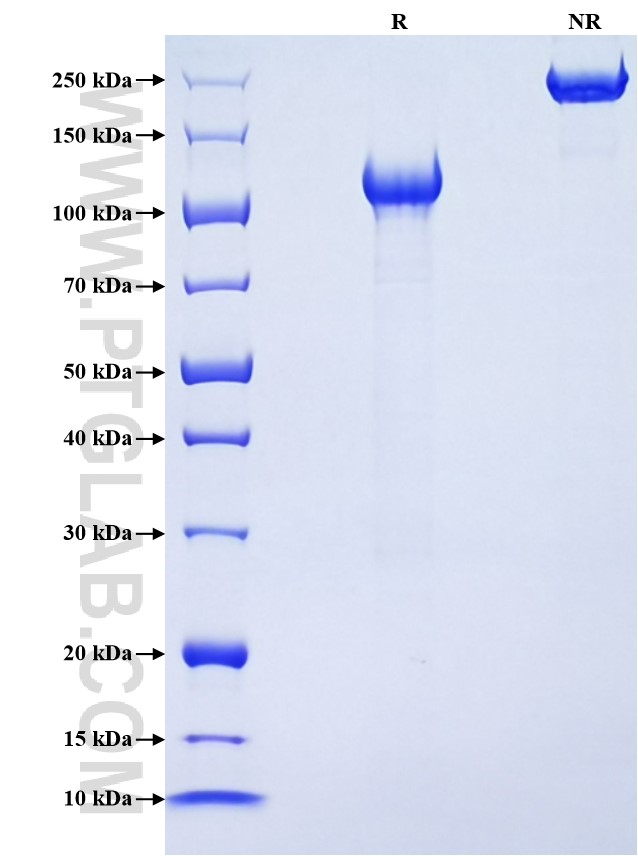 Purity of Recombinant Human CD93 was determined by SDS-PAGE. The protein was resolved in an SDS-PAGE in reducing (R) and non-reducing (NR) conditions and stained using Coomassie blue.