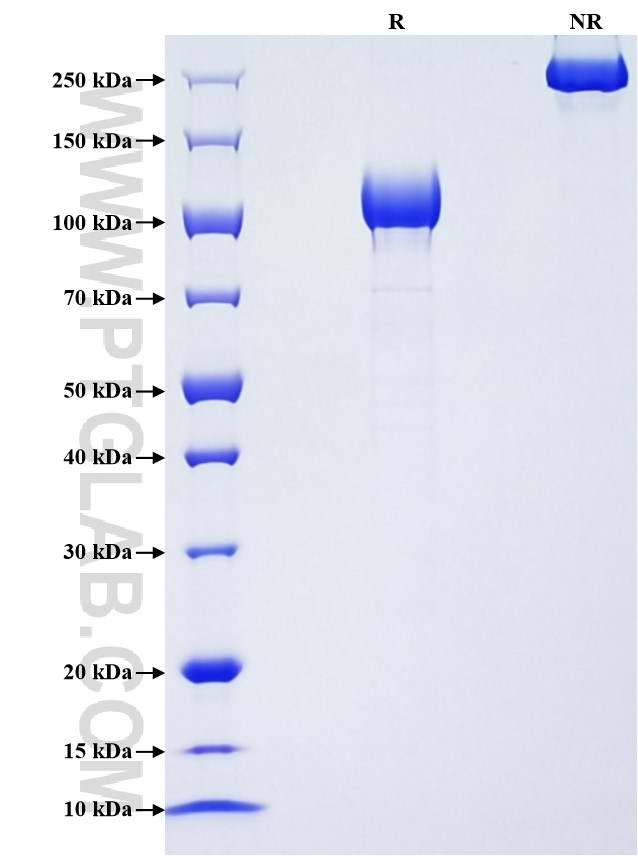 Purity of Recombinant Human G-CSFR was determined by SDS-PAGE. The protein was resolved in an SDS-PAGE in reducing (R) and non-reducing (NR) conditions and stained using Coomassie blue.