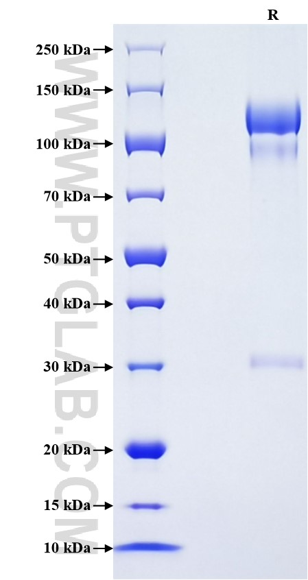Purity of Recombinant Mouse Uromodulin was determined by SDS-PAGE. The protein was resolved in an SDS-PAGE in reducing (R) conditions and stained using Coomassie blue.