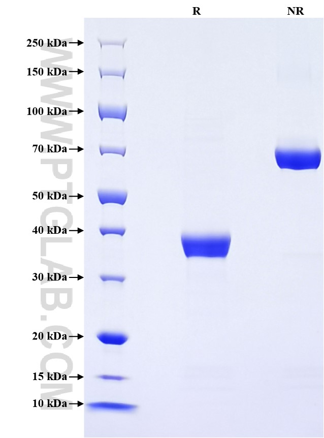 Purity of Recombinant Human CXCL3 was determined by SDS-PAGE. The protein was resolved in an SDS-PAGE in reducing (R) and non-reducing (NR) conditions and stained using Coomassie blue. Purity of Recombinant Human CXCL3 was determined by SDS-PAGE. The protein was resolved in an SDS-PAGE in reducing (R) and non-reducing (NR) conditions and stained using Coomassie blue.