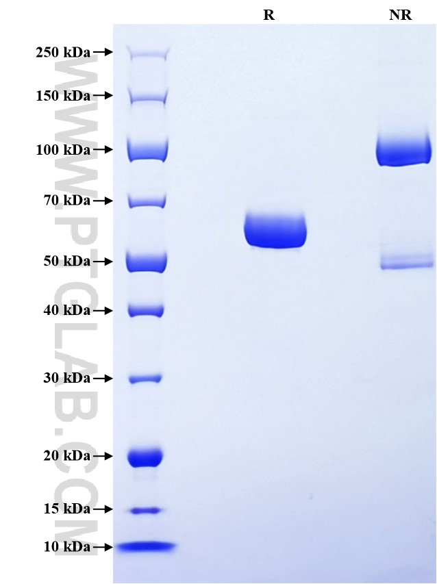 Purity of Recombinant Human Entactin was determined by SDS-PAGE. The protein was resolved in an SDS-PAGE in reducing (R) and non-reducing (NR) conditions and stained using Coomassie blue. Purity of Recombinant Human Entactin was determined by SDS-PAGE. The protein was resolved in an SDS-PAGE in reducing (R) and non-reducing (NR) conditions and stained using Coomassie blue.