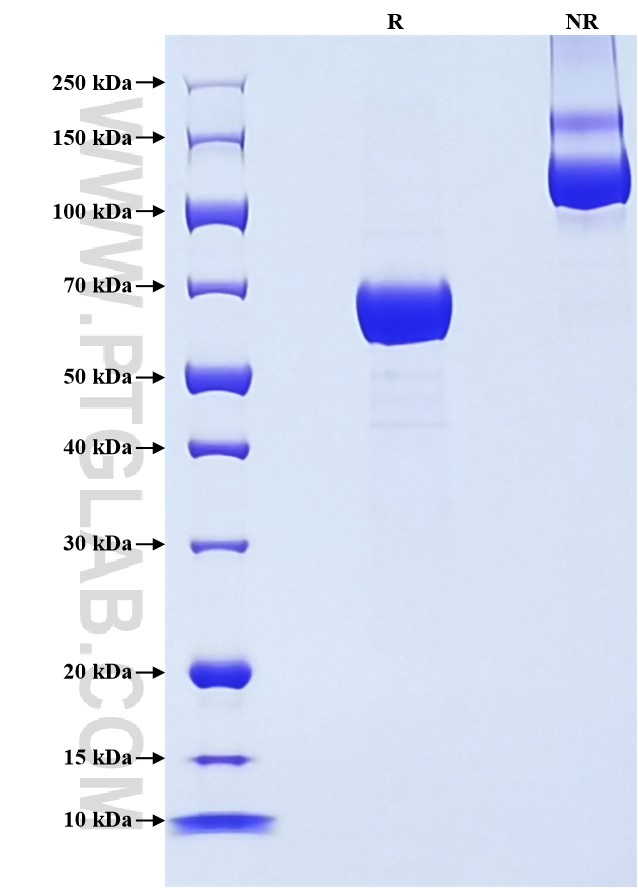 Purity of Recombinant Mouse ATP1B1 was determined by SDS-PAGE. The protein was resolved in an SDS-PAGE in reducing (R) and non-reducing (NR) conditions and stained using Coomassie blue. Purity of Recombinant Mouse ATP1B1 was determined by SDS-PAGE. The protein was resolved in an SDS-PAGE in reducing (R) and non-reducing (NR) conditions and stained using Coomassie blue.