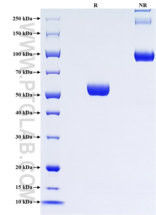Purity of Recombinant Human Granzyme A was determined by SDS-PAGE. The protein was resolved in an SDS-PAGE in reducing (R) and non-reducing (NR) conditions and stained using Coomassie blue. Purity of Recombinant Human Granzyme A was determined by SDS-PAGE. The protein was resolved in an SDS-PAGE in reducing (R) and non-reducing (NR) conditions and stained using Coomassie blue.