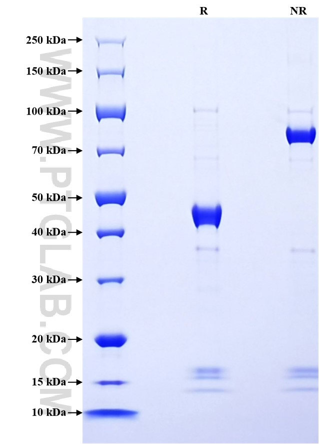 Purity of Recombinant Mouse Midkine was determined by SDS-PAGE. The protein was resolved in an SDS-PAGE in reducing (R) and non-reducing (NR) conditions and stained using Coomassie blue. Purity of Recombinant Mouse Midkine was determined by SDS-PAGE. The protein was resolved in an SDS-PAGE in reducing (R) and non-reducing (NR) conditions and stained using Coomassie blue.