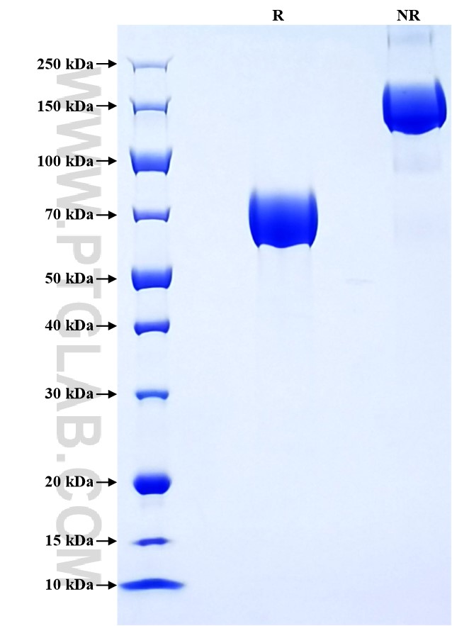 Purity of Recombinant Human GHR was determined by SDS-PAGE. The protein was resolved in an SDS-PAGE in reducing (R) and non-reducing (NR) conditions and stained using Coomassie blue.