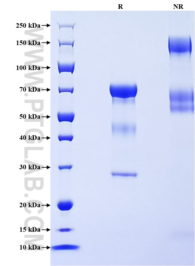 Purity of Recombinant Mouse Cathepsin B was determined by SDS-PAGE. The protein was resolved in an SDS-PAGE in reducing (R) and non-reducing (NR) conditions and stained using Coomassie blue.