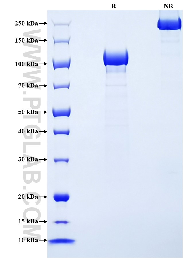 Purity of Recombinant Human Tie1 was determined by SDS-PAGE. The protein was resolved in an SDS-PAGE in reducing (R) and non-reducing (NR) conditions and stained using Coomassie blue. Purity of Recombinant Human Tie1 was determined by SDS-PAGE. The protein was resolved in an SDS-PAGE in reducing (R) and non-reducing (NR) conditions and stained using Coomassie blue.