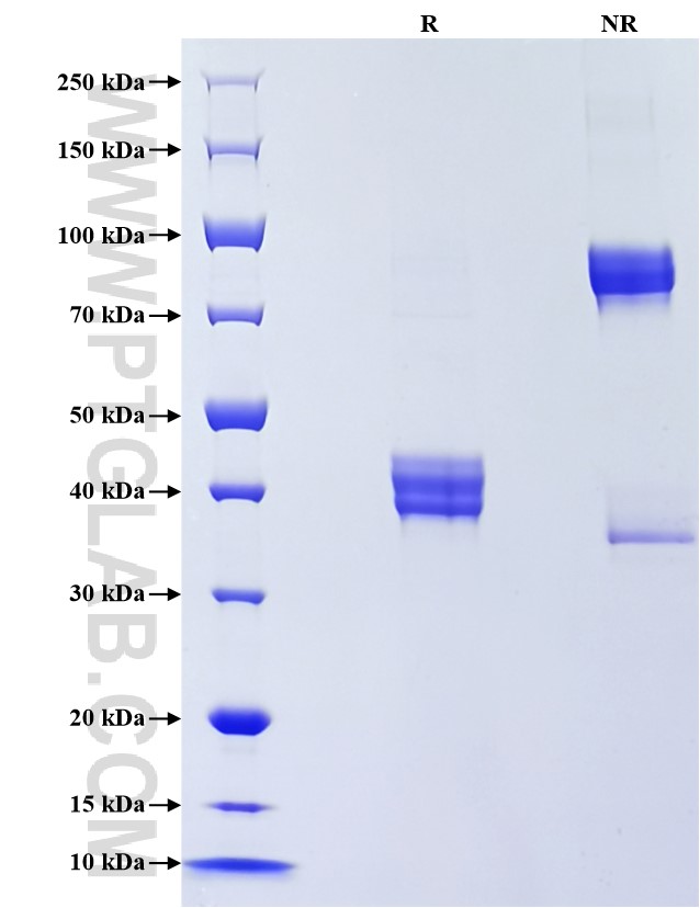 Purity of Recombinant Human Galanin was determined by SDS-PAGE. The protein was resolved in an SDS-PAGE in reducing (R) and non-reducing (NR) conditions and stained using Coomassie blue. Purity of Recombinant Human Galanin was determined by SDS-PAGE. The protein was resolved in an SDS-PAGE in reducing (R) and non-reducing (NR) conditions and stained using Coomassie blue.