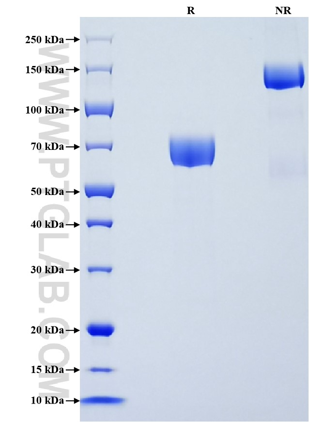 Purity of Recombinant Mouse IL-21R was determined by SDS-PAGE. The protein was resolved in an SDS-PAGE in reducing (R) and non-reducing (NR) conditions and stained using Coomassie blue. Purity of Recombinant Mouse IL-21R was determined by SDS-PAGE. The protein was resolved in an SDS-PAGE in reducing (R) and non-reducing (NR) conditions and stained using Coomassie blue.