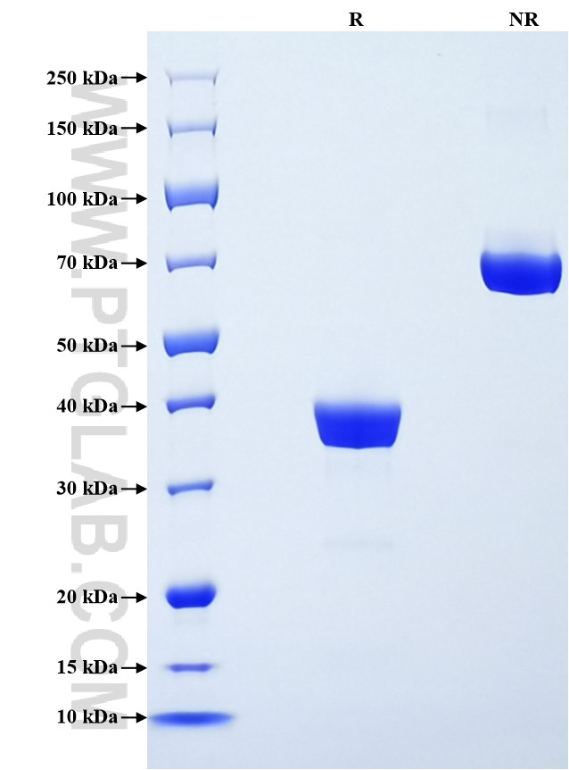 Purity of Recombinant Human CXCL5 was determined by SDS-PAGE. The protein was resolved in an SDS-PAGE in reducing (R) and non-reducing (NR) conditions and stained using Coomassie blue. Purity of Recombinant Human CXCL5 was determined by SDS-PAGE. The protein was resolved in an SDS-PAGE in reducing (R) and non-reducing (NR) conditions and stained using Coomassie blue.