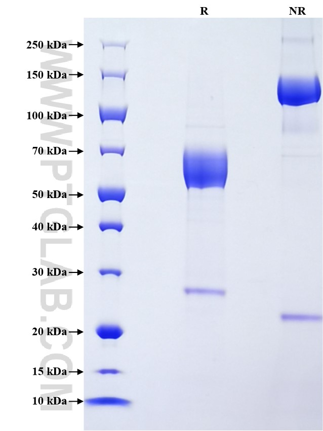 Purity of Recombinant Mouse CD74 was determined by SDS-PAGE. The protein was resolved in an SDS-PAGE in reducing (R) and non-reducing (NR) conditions and stained using Coomassie blue.