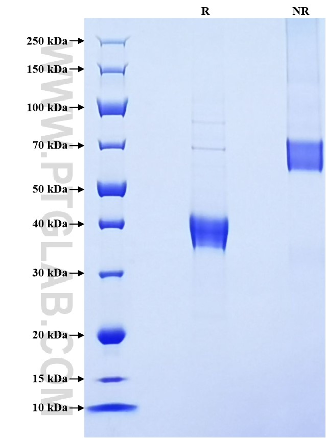 Purity of Recombinant Human DEFB119 was determined by SDS-PAGE. The protein was resolved in an SDS-PAGE in reducing (R) and non-reducing (NR) conditions and stained using Coomassie blue.